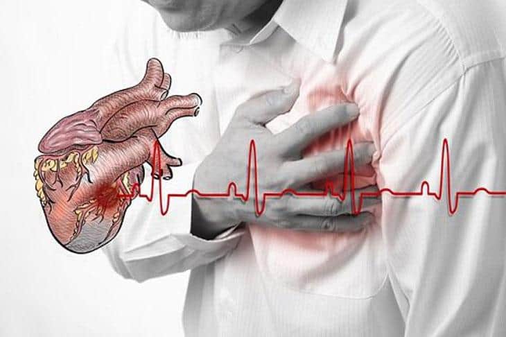 Phòng chống bụi mịn để giảm thiểu ảnh hưởng tới tim mạch